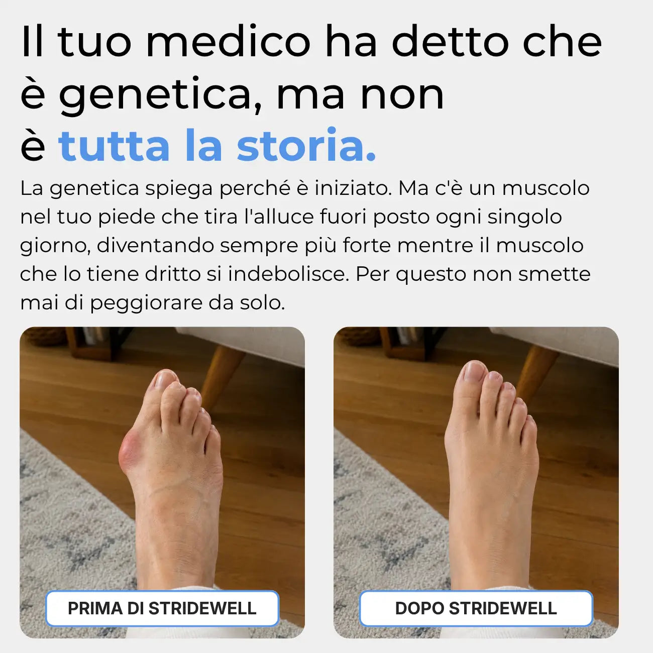 Correttore per alluce valgo Stridewell™ — Riallinea il tuo alluce senza intervento chirurgico