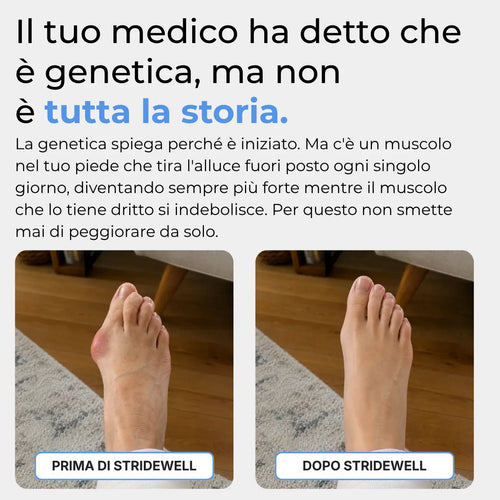 Correttore per alluce valgo Stridewell™ — Riallinea il tuo alluce senza intervento chirurgico