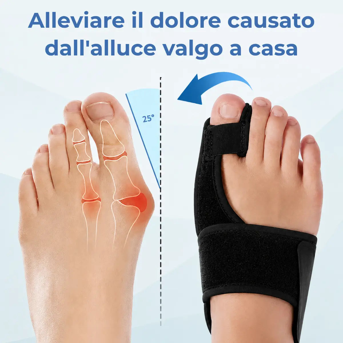 Torna a Camminare Senza Dolore — Correttore per Alluce Valgo