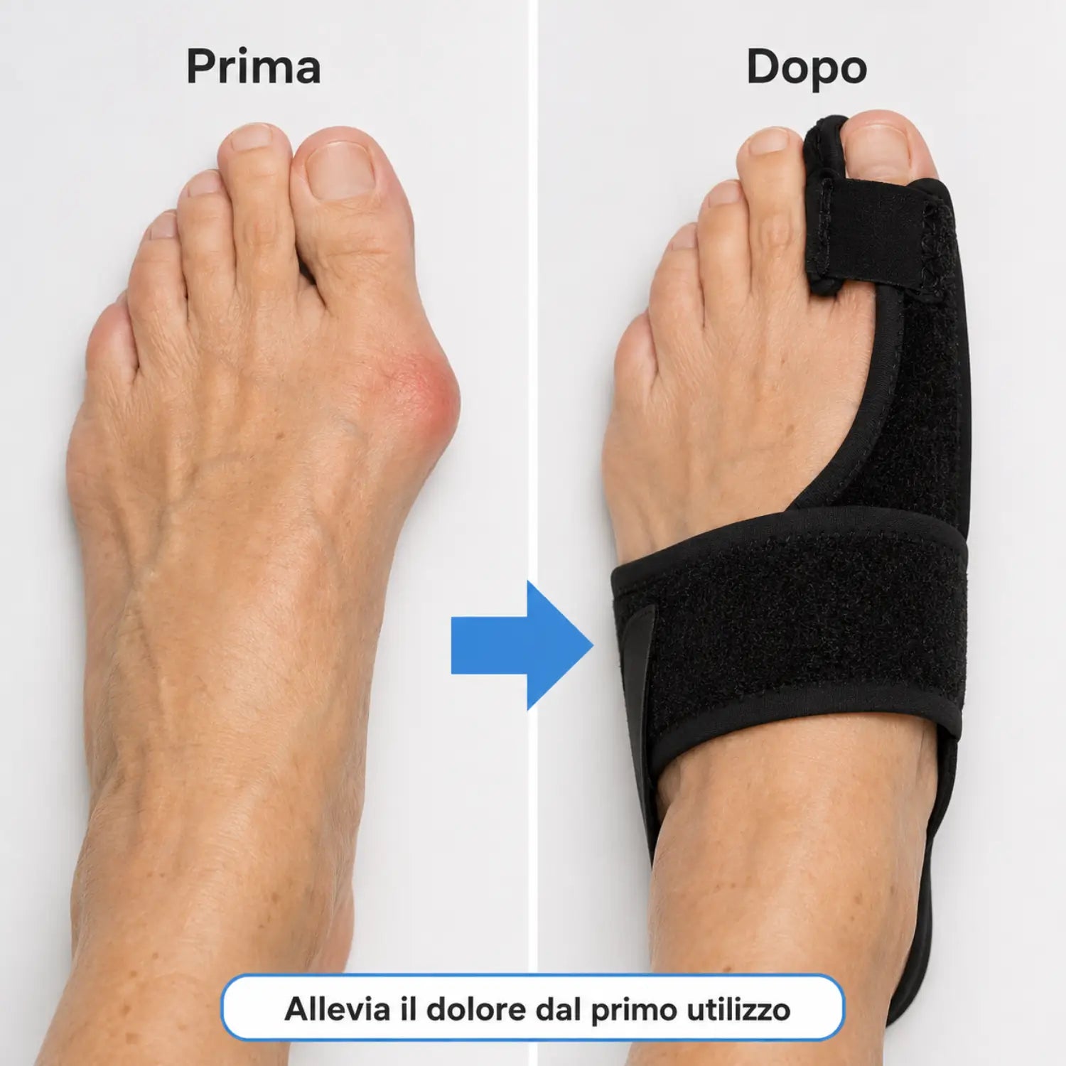 Torna a Camminare Senza Dolore — Correttore per Alluce Valgo